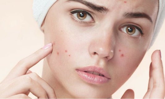 Organic Beauty Products For Acne-Prone Skin